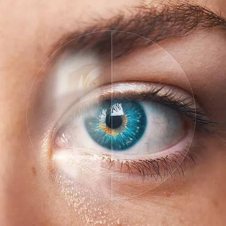 Traitement anti-reflet